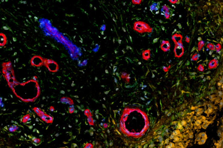 Mestag Therapeutics宣布完成4500万美元种子轮融资