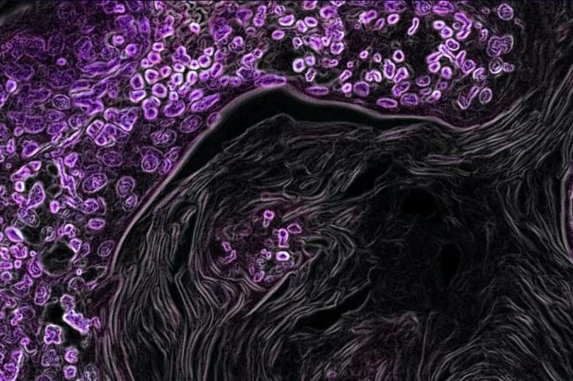 新锐！Parthenon Therapeutics完成6500万美元A轮融资