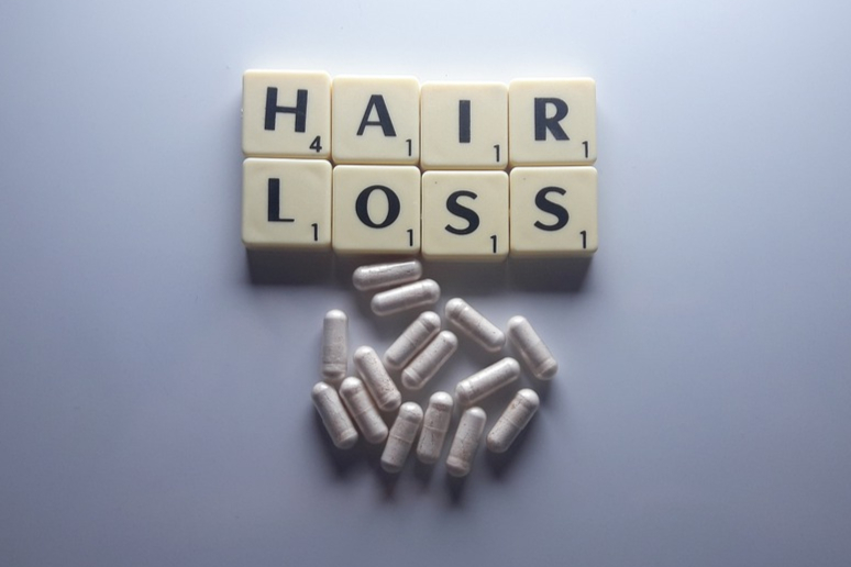 米诺地尔新剂型报上市，雄激素性脱发者福音！JAK抑制剂进度喜人