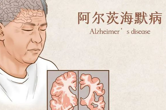 千亿神经系统药物市场：红海被猛攻抢夺，蓝海入局者寥寥！