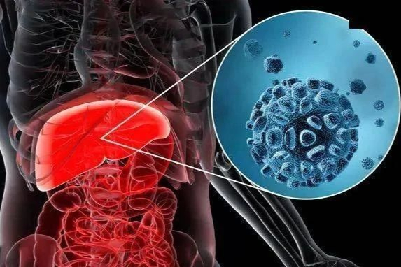 刚刚！凯因科技乙肝新药获批临床，HBsAg单抗治疗关键有效