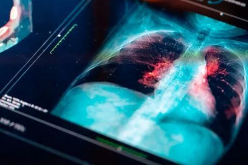 治愈乙肝的曙光在哪里？盘点乙肝治疗新药研发进展