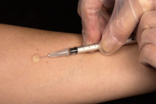 中国抗体制药：抗CD22单抗上市申请获受理