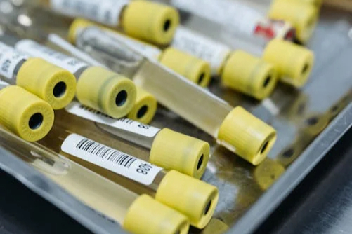 重磅！首场全国联盟耗材集采自7月4日正式启动