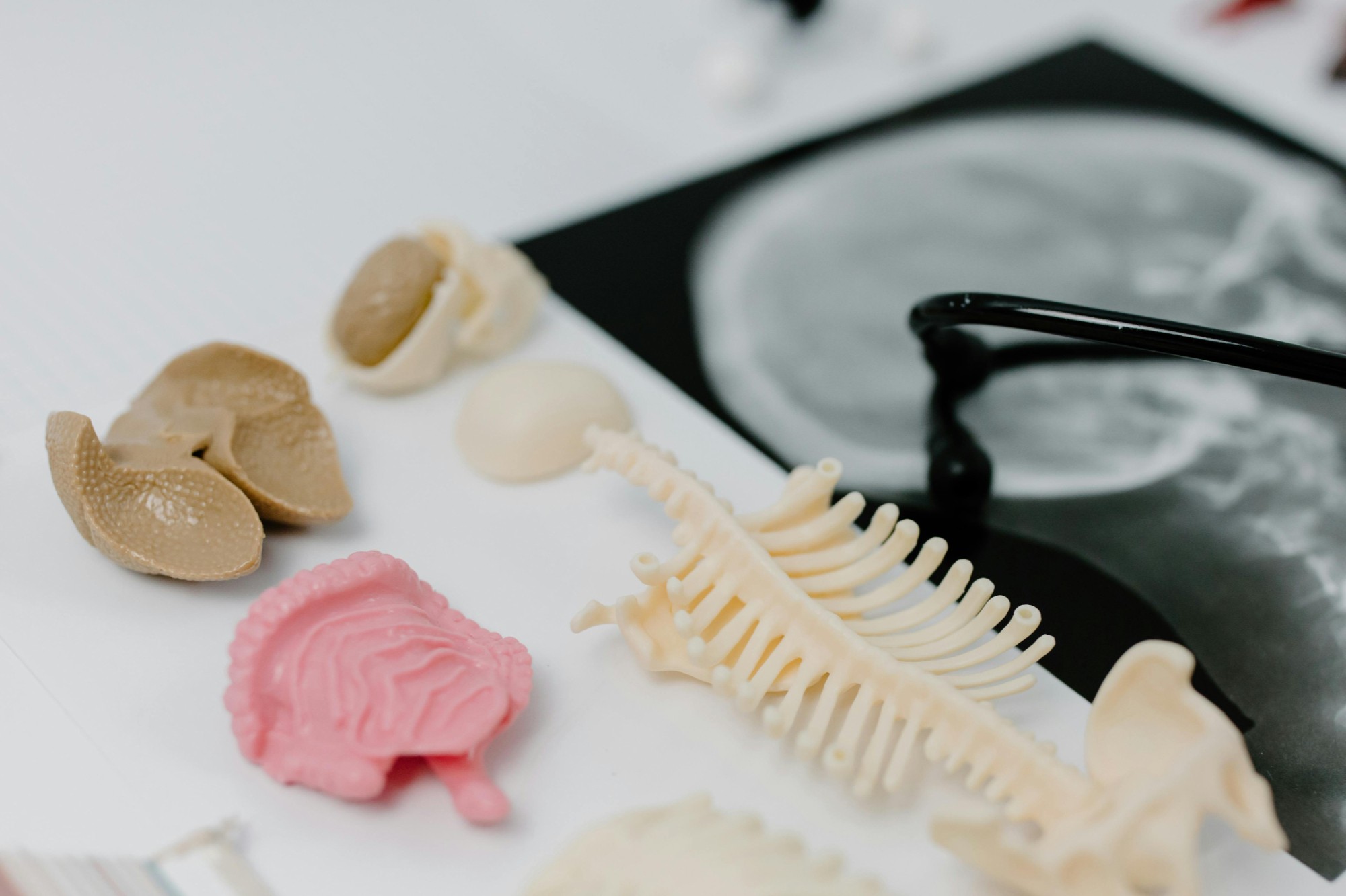 百济神州BTK抑制剂头对头击败伊布替尼！国产重磅品种临床数据解读