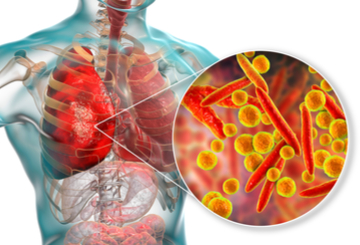 2023年美国临床肿瘤学会最佳会议（Best of ASCO Seattle 2023）